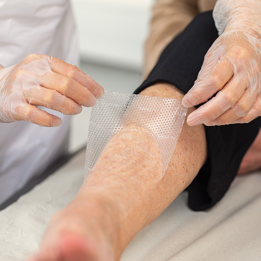 Curativo Camada Contato Malha de Silicone  Mepitel One 7,5x10 Unidade - Imagem 3