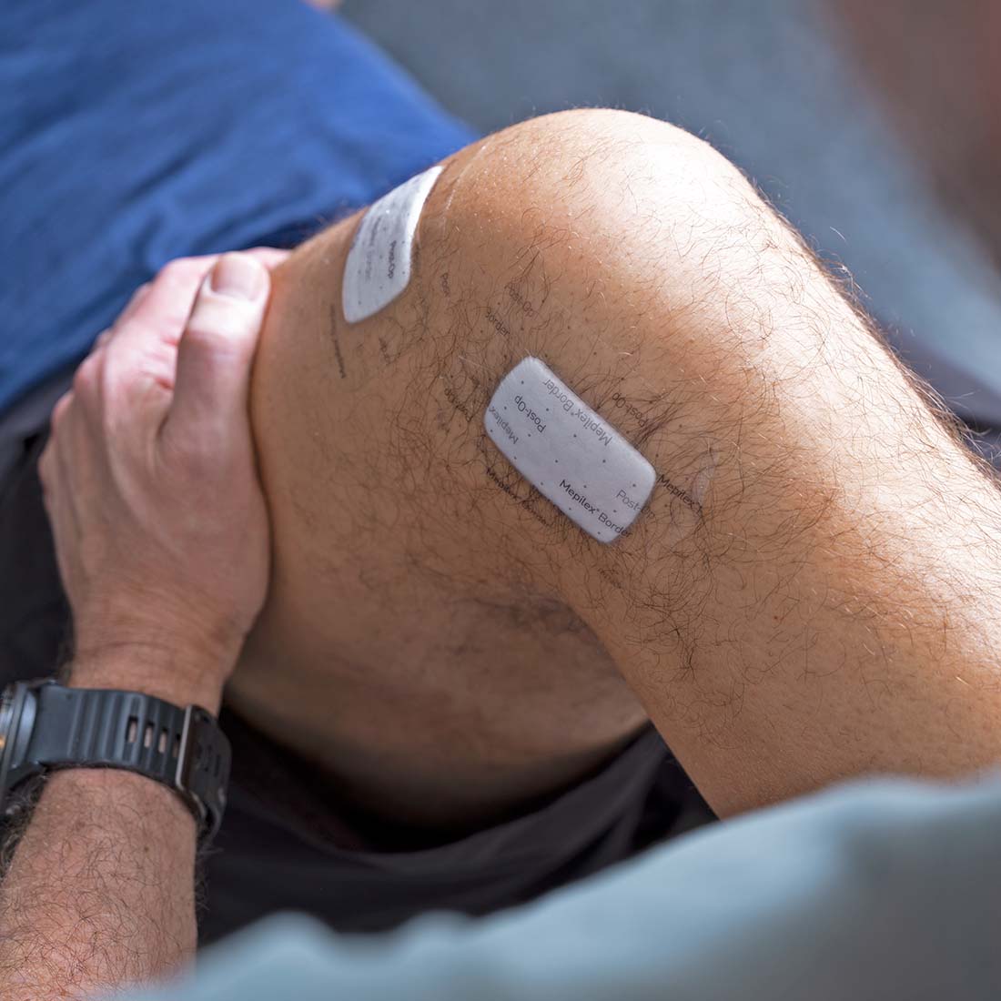 Curativo Pós-operatório Mepilex Border  Post-Op 10x15 Unidade - Imagem 6