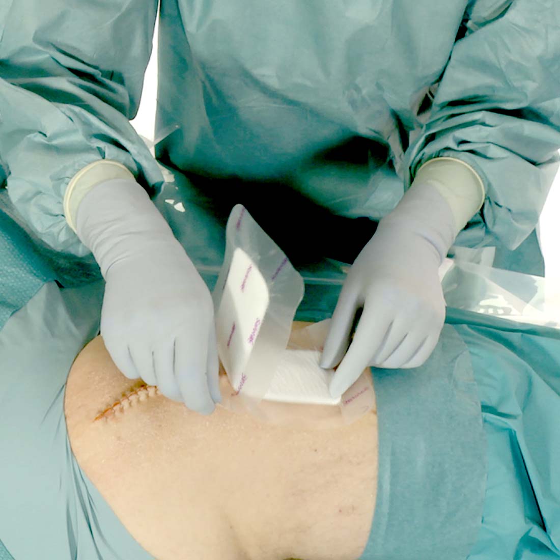 Curativo Pós-operatório Mepilex Border Post-Op 10x20 Unidade - Imagem 3