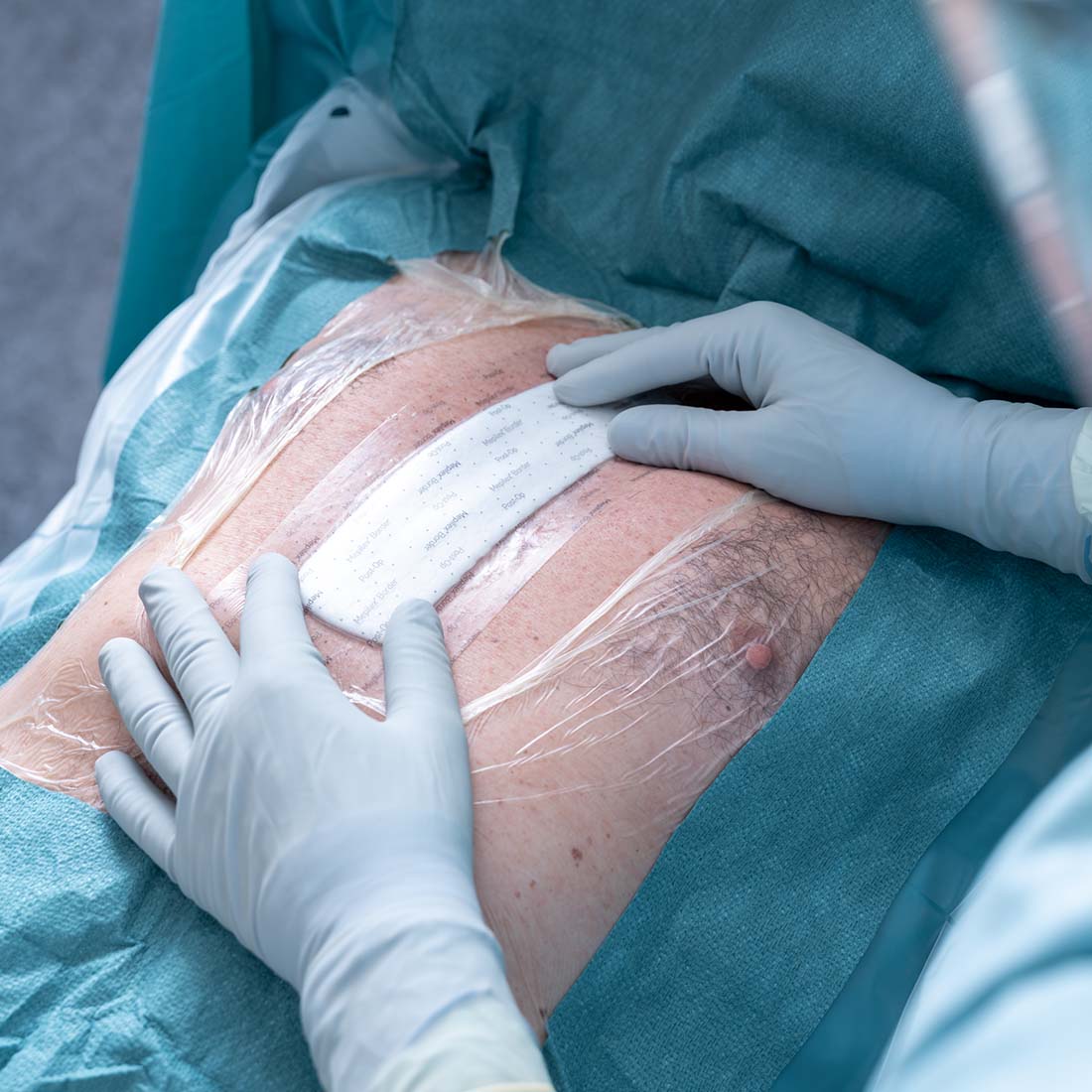 Curativo Pós-operatório Mepilex Border Post-Op 10x20 Unidade - Imagem 5