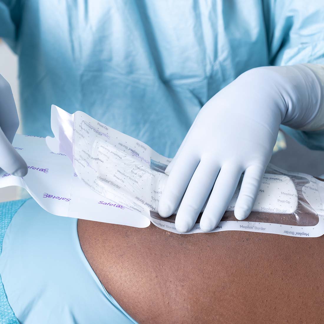 Curativo Pós-operatório Mepilex Border Post-Op 10x20 Unidade - Imagem 6