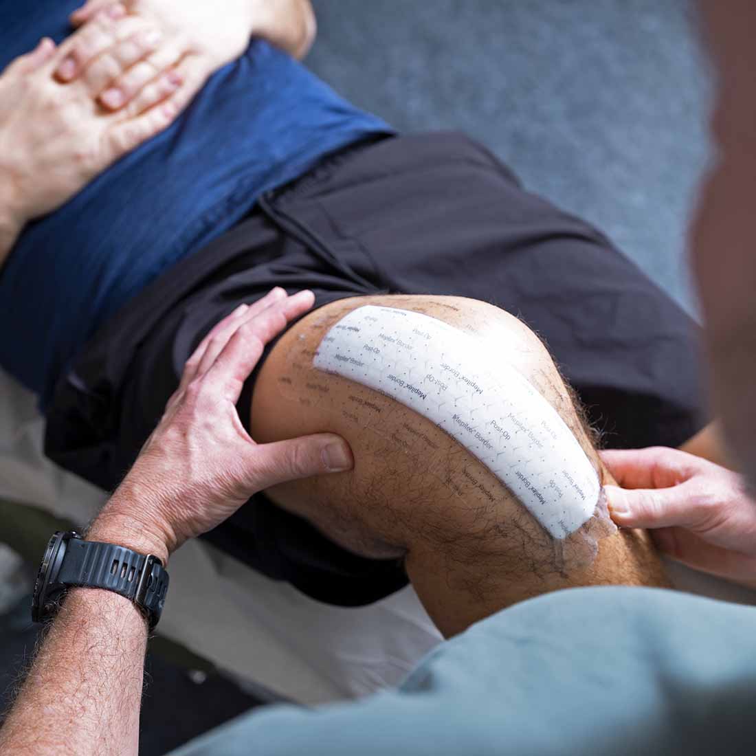 Curativo Pós-operatório Mepilex  Border Post-Op 10x30 Unidade - Imagem 4