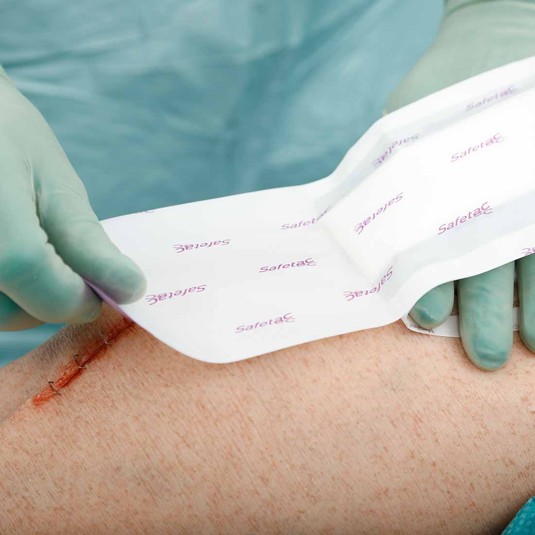 Curativo Pós-operatório Mepilex  Border Post-Op 10x30 Unidade - Imagem 2