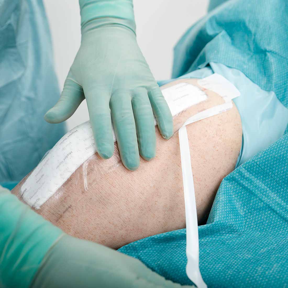 Curativo Pós-operatório Mepilex  Border Post-Op 10x30 Unidade - Imagem 3