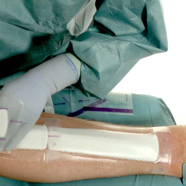 Curativo Pós-operatório Mepilex Border  Post-Op 10x35 Unidade - Image 6