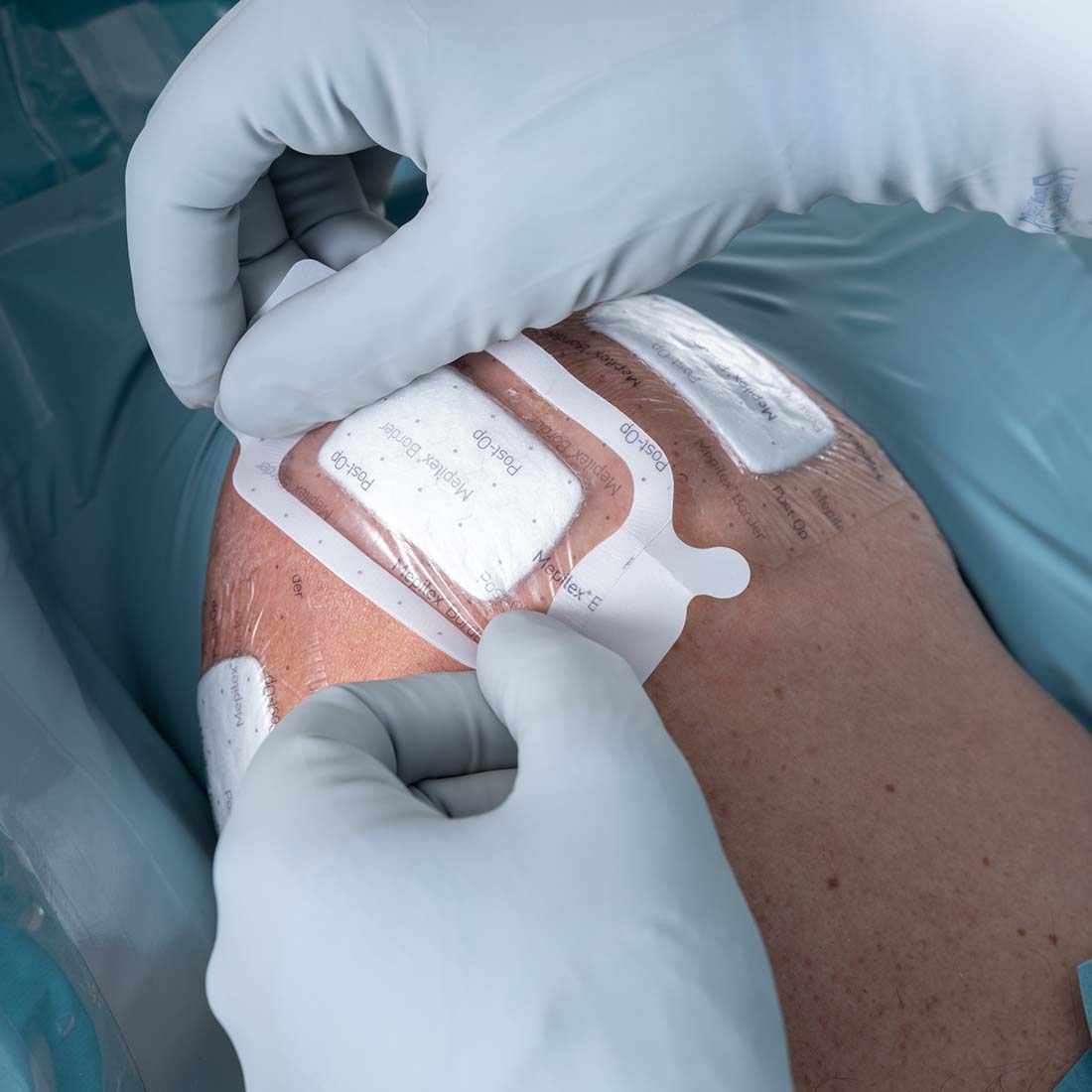 Curativo Pós-operatório Mepilex Border Post-Op 6x8 Unidade - Imagem 3